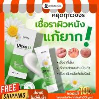 ราคา รอยดำยุงกัดหายได้!!! Ultra U อัลตร้ายู ครีมทาสะเก็ดเงิน กลาก เกลื้อน น้ำกัดเท้า เชื้อราผิวหนัง (11297212461)