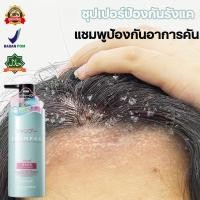 ราคา ยาสระผมขจัดรังแค คันหนังศีรษะ ยาสระผมแก้คัน 500ml คนท้องใช้ได้ค่ะ หยุดอาการคัน ยาสระผมเชื้อรา ขจัดรังแค ควบคุมน้ำมัน (25165363318)