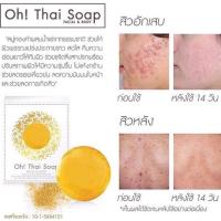 ราคา สบู่ohthaisoapทองคำผสมน่ำแร่ (37428040)