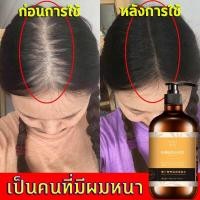ราคา แชมพูขิง500ML แชมพูแก้ผมร่วง แชมพูสมุนไพร แชมพูชายหญิง แชมพูเร่งผมยาว แชมพูแก้ผมหงอก แชมพู ป้องกัน ร่วง แชมพูขจัดรังแค (6962562931)
