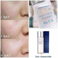 ราคา Tony Moly Intense Care Galactomyces Lite Essence 96.5% 120 ml ** สีน้ำเงิน ** (910140074)