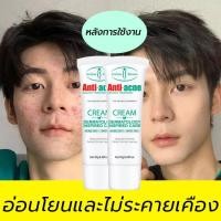 ราคา aichun ครีมแต้มสิว ครีมแต้มสิว 20g กําจัดสิว ลดสิว ลดรอยสิว กําจัดสิวและรอยสิว ละลายสิวหัวดํา ซ่อมแซมใบหน้า (40568338717)
