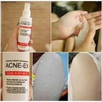 ราคา Acne-Ex Body Mis สเปรย์รักษาสิว/120มล. (745498490)