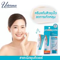 ราคา Uderma Bio Acne Cream 5 กรัม ยูเดอร์มา ไบโอ แอคเน่ ครีมแต้มสิวยูเดอร์มา ✨ (27574831207)