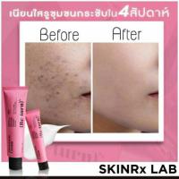 ราคา Skinrx Lab Madecera cream 15 ml. และ 50ml. (5616765280)