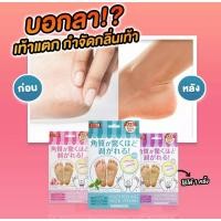 ราคา Perorin Peeling ถุงลอกเท้า นำเข้าจากญี่ปุ่น (8428235251)