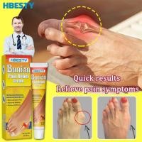 ราคา Bunion cream ลดปวด ลดอักเสบ นิ้วโป้งโค้งงอเข้า Hallux valgus ปวดเท้า ปวดข้อ ปวดบวม ข้ออักเสบ ข้อบวม ข้อต่อนิ้วเท้า (24457639410)