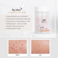 ราคา [ลด 15% โค้ดคุ้มพร้อมส่ง!!] Acno+ วิตามินลดสิว เคลียร์จบครบทุกสิว เคลียร์ทุกรอย จากต้นตอปัญหาสิว (29419298499)