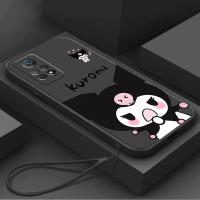 ราคา เคส Redmi note 11Pro 4G Redmi note 11Pro 5G Redmi note11Pro+ 5G Redmi note 11 Pro Plus 5G Redmi note 12Pro 4GTpuแฟชั่นlanyard soft case RXGSเคสโทรศัพท์ (27160911569)