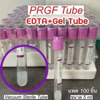 ราคา PRGF แยกเซรั่ม หลอดใส่เลือดสูญญากาศ ชนิดมีสารกันเลือดแข็งK3 EDTA + Gel Vacuum ขนาด 13x100 MM ปริมาตร 5mL แพค 100 หลอด (28527311338)