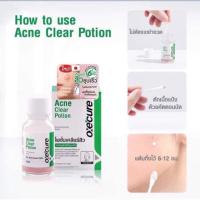 ราคา Oxe'Cure Acne Clear Potion 15ml สูตรลับไร้สิวด้วยแป้งน้ำชมพูแต้มสิว 1 ขวด (22746890798)