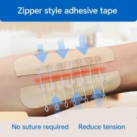 ราคา สะดวกและง่าย แผ่นปิดแผลแบบซิปทางการแพทย์ ลดความตึงของแผลโดยไม่ต้องเย็บ ใช้งานง่าย ใช้ครั้งเดียว (43072271188)