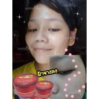 ราคา ครีมรักษากระ ฝ้า สิว จุดด่างดำ (18732114382)