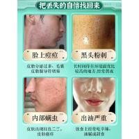 ราคา ลังโคมผู้ชายชุดผลิตภัณฑ์ดูแลผิวของแท้น้ําโลชั่นทําความสะอาดผิวหน้าชุ่มชื้นสดชื่นควบคุมน้ํามันกําจัดสิวสิวหัวดํากล่องของขวัญ (42970479290)