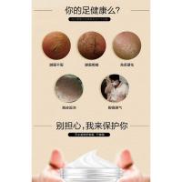 ราคา ครีมทาส้นเท้าแตก ขนาด 30 ml จบปัญหาส้นเท้าแตก (3464054891)