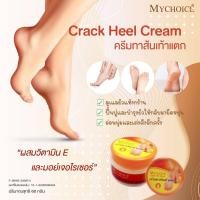 ราคา ครีมแก้ส้นเท้าแตก ครีมบำรุงเท้า ครีมทาส้นเท้าแตกมายช้อยส์ ครีมเท้าแตก ปริมาณ 60 กรัม (11724735968)