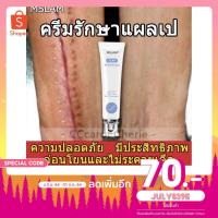 ราคา เร่งการ ซ่อมแซมให้ผิว ครีมลบแผลเป็น ครีมลดรอยแผล ยารักษาแผลเป็น ยาทาแผลเป็นนูน เจลลบรอยแผลเป็น ครีมทาแผลเป็น (10702578587)