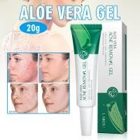 ราคา Crazyi 20g Aloe Gel Face Cream Oil Control Moisturizing Acne Treatment Skin Care (10182624568)