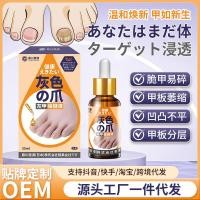 ราคา Onychomycosis การดูแลสุขภาพภายนอก Liquid Hand Foot Nails หนา Brightening Nails Onychomycosis Foot Care Liquid One Piece Shi (40522825645)
