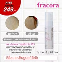 ราคา Fracora Placenta Clear Treatment Lotion 30 ml. (963089758)
