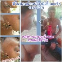 ราคา มายริช ผลิตภัณฑ์เสริมอาหาร - พลูคาวสกัดเย็น (My Rich Dietary Supplement Product) (27732147174)