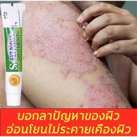 ราคา จัดส่งได้ทันที ครีมทาพิษเปียก ครีมสมุนไพรจีนครีม เป็นต้นฉบับครีมทารักษาโรคสะเก็ดเงิน โรคผิวหนัง เชื้อรา หนังศรีษะ (14208135631)