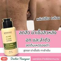ราคา Acne Care น้ำตบ ลดสิว สิวอักเสบ สิวผด สิวยีสต์ ที่หลัง อก และลำตัว สูตรยา สูตรคลินิก (24821850742)