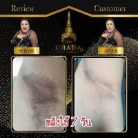 ราคา เซรั่มตรีชฎา เซรั่มรักแร้ดำ ขรุขระ คอดำ ข้อศอก ขี้ไคล ขาหนีบ (16760022242)