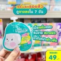ราคา mizumi เซรั่มลดรอยสิวเขียว 1กล่อง6ซอง (22556732363)