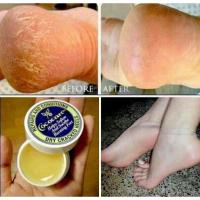 ราคา ของแท้!!ครีมทาส้นเท้าแตกที่ดีที่สุดCococare Repair and Condition dry cracked heels 11 g. (19476476633)