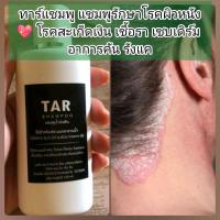 ราคา ทาร์แชมพู แชมพูรักษาโรคผิวหนัง โรคสะเก็ดเงิน เชื้อรา เซบเดิร์ม อาการคัน รังแค (120 มล.) (16649004385)