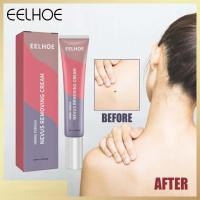 ราคา ผิวแท็กกำจัดหูดการรักษาคอใบหน้าเท้าหูด Remover ครีมกับไฝครีมกำจัดหูดพลาสเตอร์ทางการแพทย์ Booboom (18469827034)