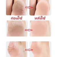 ราคา แผ่นเสริมส้น ซิลิโคนรองส้นเท้า ใส่ได้ทั้งชายหญิง แก้ปวดส้นเท้า ถนอมส้นเท้า แก้ปวดส้นเท้า รองช้ำ ส้นเท้าแตก (29406090401)