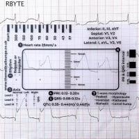 ราคา RBYTE ECG 7 Step ไม้บรรทัดการ์ด,Interpretation แบบพกพาแบบพกพา Ecg/Ekg คู่มืออ้างอิง, พกพาสะดวกเครื่องมือวัด Clear วัด Ekg Interpretation ไม้บรรทัดสําหรับ ECG Assessment (44901053881)