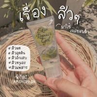 ราคา เจซ่อมผิวเอริกะ​ ( Erika )​ (5943234967)