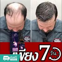 ราคา 【ปลูกผมเร็ว】เซรั่มปลูกผม น้ำยาปลูกผมดก น้ำยาเร่งผมยาว ยาปลูกผมของแท้ น้ำยาปลูกผมผู้ชาย ป้องกันผมร่วง ทำให้รากผมแข็งแรงมา (26627771267)