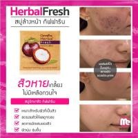 ราคา สบู่ล้างหน้า ผสมเปลือกมังคุด กิฟฟารีน รักษาสิว ฝ้า ริ้วรอย หน้าขาวกระจ่างใส Herbal Fresh Mangosteen Peel Glycerin Soap (12515292149)