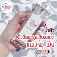 ราคา Gentle Defense cream ช่วยลดผด ผื่นแดง ปัญหาสิวต่างๆ ลดการอักเสบของผิว 15 ml. (303603580)