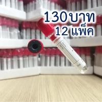 ราคา Clot Activator Tube (จุกสีแดง) หลอดเก็บตัวอย่างเลือด ขนาด 5.0 mL ( 100 หลอดราคา 130 บาท ) (8612608216)