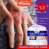 ราคา ครีมรักษาผื่นแพ้ที่มีฤทธิ์ต้านเชื้อแบคทีเรีย ครีมบรรเทาอาการคันสำหรับผิวหนัง ครีมช่วยลดอาการคันจากโรคสะเก็ดเงิน ครีมต้านการคันส่วนบุคคล ขนาด 30 กรัม (29291150723)