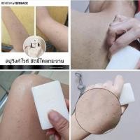 ราคา wink white soap สบู่ระเบิดขี้ไคล (7717171842)