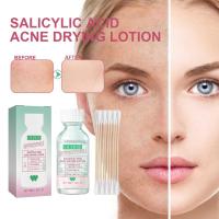 ราคา Salicylic Acid Acne Drying Lotion Anti-Acne Serum Spot Treatment สําหรับผิวใส (27220565107)