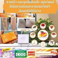 ราคา สบู่รักษาสิวที่หลัง รักแร้ดำ ผื่นคันตามตัว สบู่มะม่วงบราซิล 1 ก้อน 120 กร้ม ใช้ได้แบบก้อน/น้ำ สบู่เหลว SMT Quinns soap (3510064976)