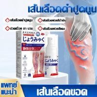 ราคา ☘️ไม่ได้ผลคืนเงิน☘️ ครีมทาเส้นเลือดขอด รักษาขาให้สวย ครีมเส้นเลือดขอด กลับคืนสุขภาพเท้า Varicose Vein Cream (57552075114)