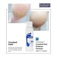 ราคา footlogix cracked heel formula 3+ : แก้ปัญหาส้นเท้าแตก (7793933313)