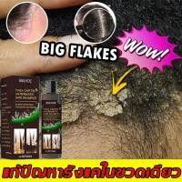 ราคา EELHOE ยาสระผมขจัดรังแค 100ml แชมพูรังแค แชมพูคัน แชมพูยาเชื้อรา ขจัดรังแค หยุดอาการคัน ลดผมร่วง (26172951278)