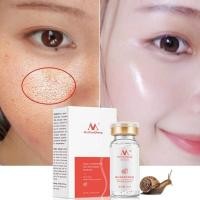 ราคา 12ml Snail Plant Extract Serum ลบริ้วรอย Anti-Aging Whitening Skin Anti-Acne Serum (57051967706)