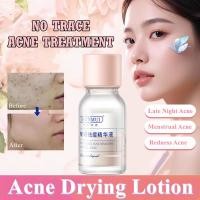 ราคา HUNMUI Salicylic Acid Acne Drying Lotion Anti-Acne Essence Water Acne Spot Treatment Care 10ml (29334161562)