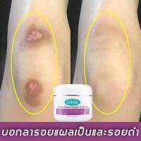 ราคา รอยแผลเปน ลอยแผลเป็น ครีมรอยแผลเป็น ฮีรูดอย แผลเป็น ครีมลดรอยแผลเป็น ทุกประเภท ลอยแผลเป็น (26438667413)