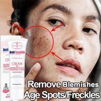 ราคา ครีมขจัดจุดด่างดํา | ไวท์เทนนิ่ง แอนด์ เมลาสม่า ทรีทเมนท์ | Even Skin Tone & Glow (45150239167)